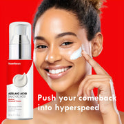 BioAcid Renewal Face Cream with Salicylic Acid & Azelaic Acid, Minimizes Appearance of Pores, Evens Light Beige, for Blemish-Prone Light Beige 1.7fl.oz