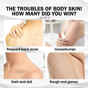 West&Month 100ml Moisturizing Body Lotion Brighten Repair Chicken Skin Dry Skin Shrink Pore Improve Dullness Smooth Body Cream