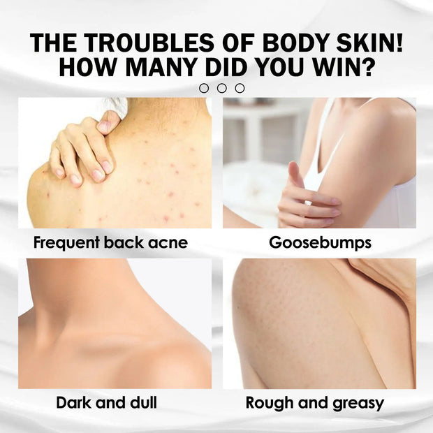 West&Month 100ml Moisturizing Body Lotion Brighten Repair Chicken Skin Dry Skin Shrink Pore Improve Dullness Smooth Body Cream