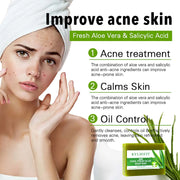 AILKE Aloe Vera Whitening Soap, Remove Spot, Pimples, Skin Radiant, Improve Skin Luster, Vegan Bath Wash for Women Men