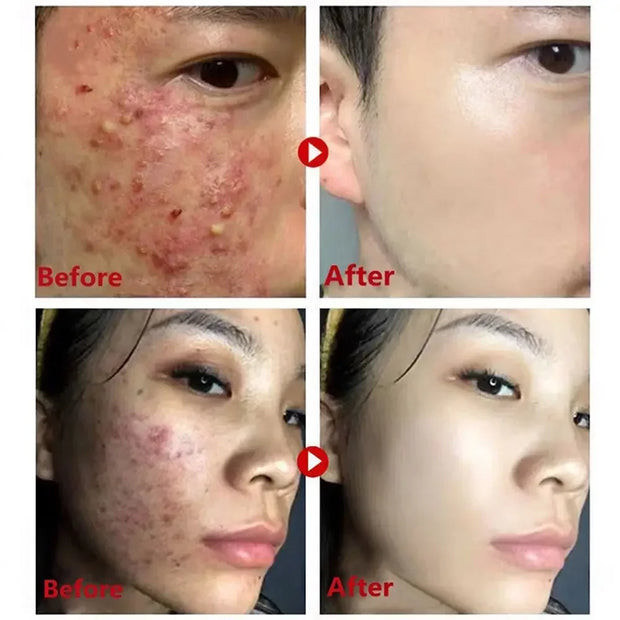 Green Tea Mask Stick Remove Blackheads Acne Deep Cleansing Purifying Clay Mask Oil Control Solid Mask Moisturizing Skin Care (Copy)