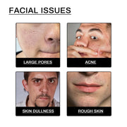 Men Facial Cleanser Lotion Remove Acne Blackhead Prevent Clogged Pores Oil Controll Exfoliator Refreshing Facial Cleaning Cream