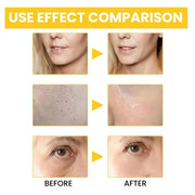 Retinol Anti Aging Remove Wrinkle Serum Lifting Brighten Face Skin Fade Eye Fine Lines Moisturizing Firming Facial Essence 30ml