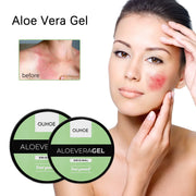 Aloe Vera Gel Nourishing Moisturizing Relieve Skin Redness After Sunburn Repair Skin Aloe Vera Gel Lotion Body and Face Skin Car
