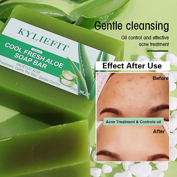 AILKE Aloe Vera Whitening Soap, Remove Spot, Pimples, Skin Radiant, Improve Skin Luster, Vegan Bath Wash for Women Men
