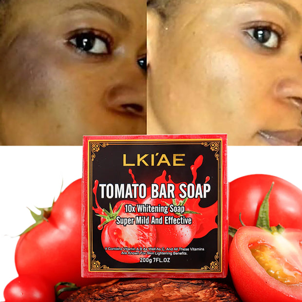AILKE Aloe Vera Whitening Soap, Remove Spot, Pimples, Skin Radiant, Improve Skin Luster, Vegan Bath Wash for Women Men