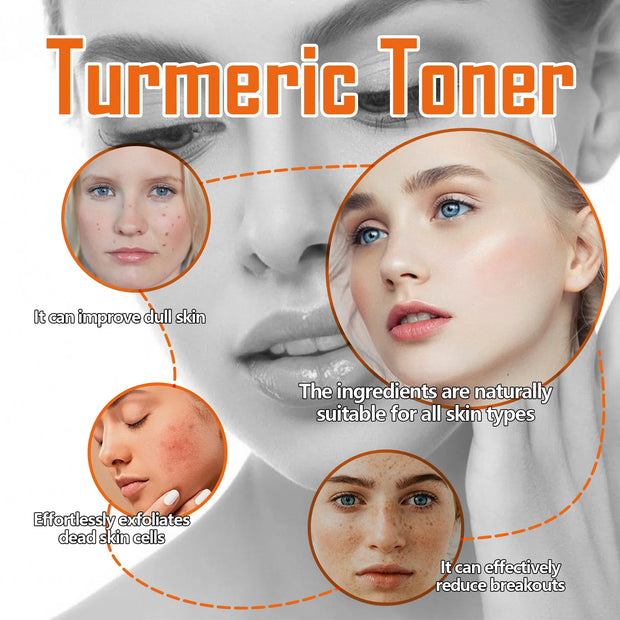 Dark Spots Removal Toner Whitening Spots Corrector Remove Freckle Lighten Melasma Pigmentation Moisturizing Turmeric Face Toner