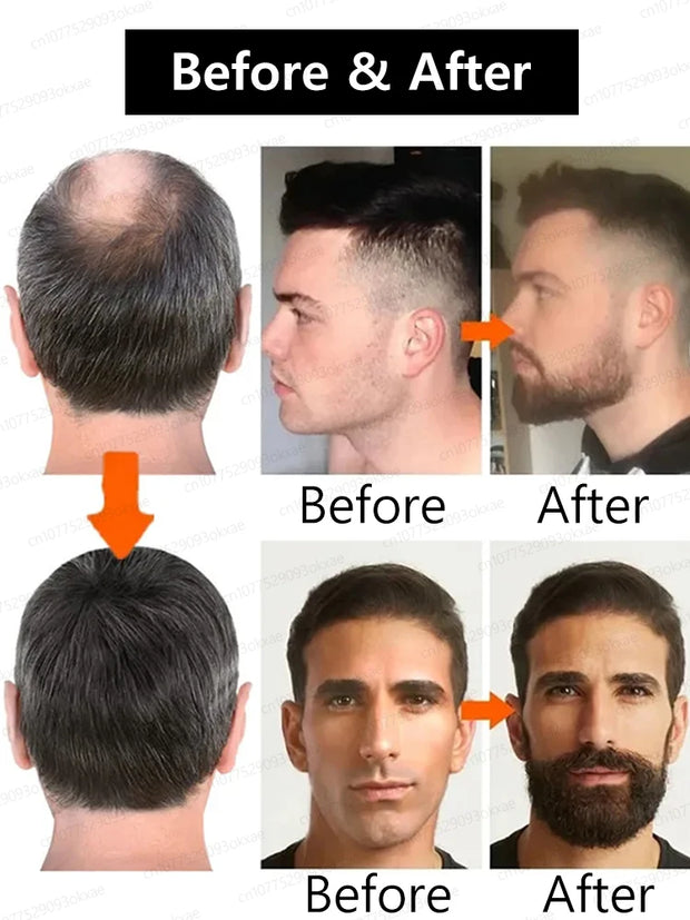 Beard Growth Serum Fast Styling Thicker Longer Fuller Beard Softening