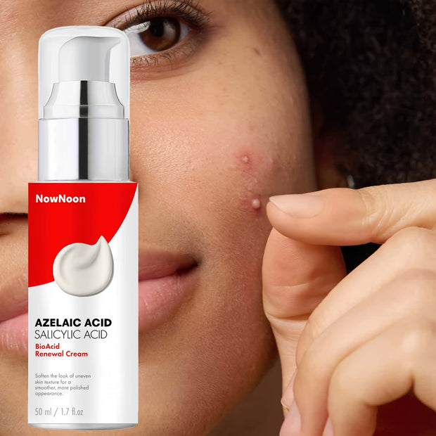 BioAcid Renewal Face Cream with Salicylic Acid & Azelaic Acid, Minimizes Appearance of Pores, Evens Light Beige, for Blemish-Prone Light Beige 1.7fl.oz